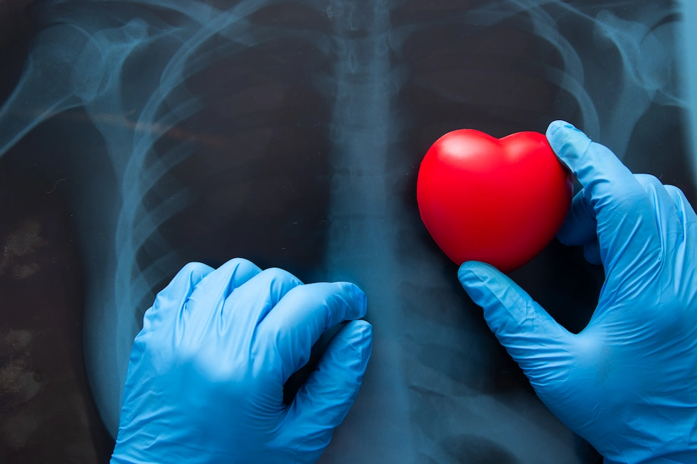 diagnostic medical inima aorta