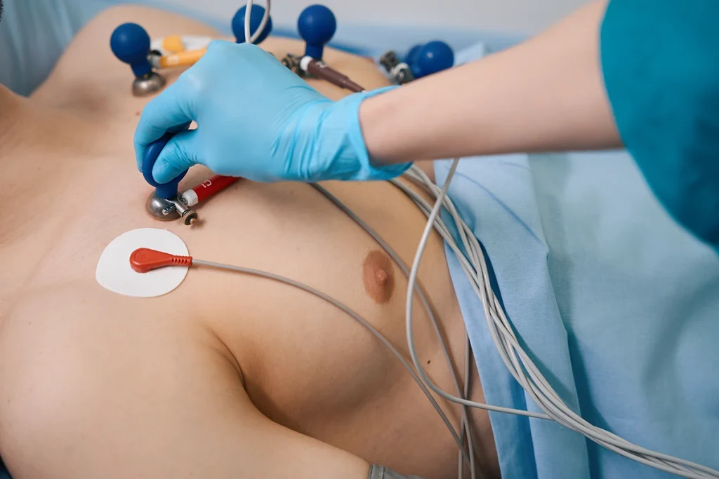 EKG sau Holter EKG