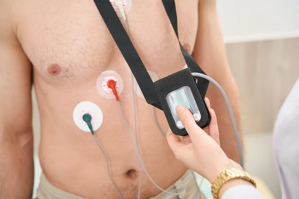 EKG sau Holter EKG