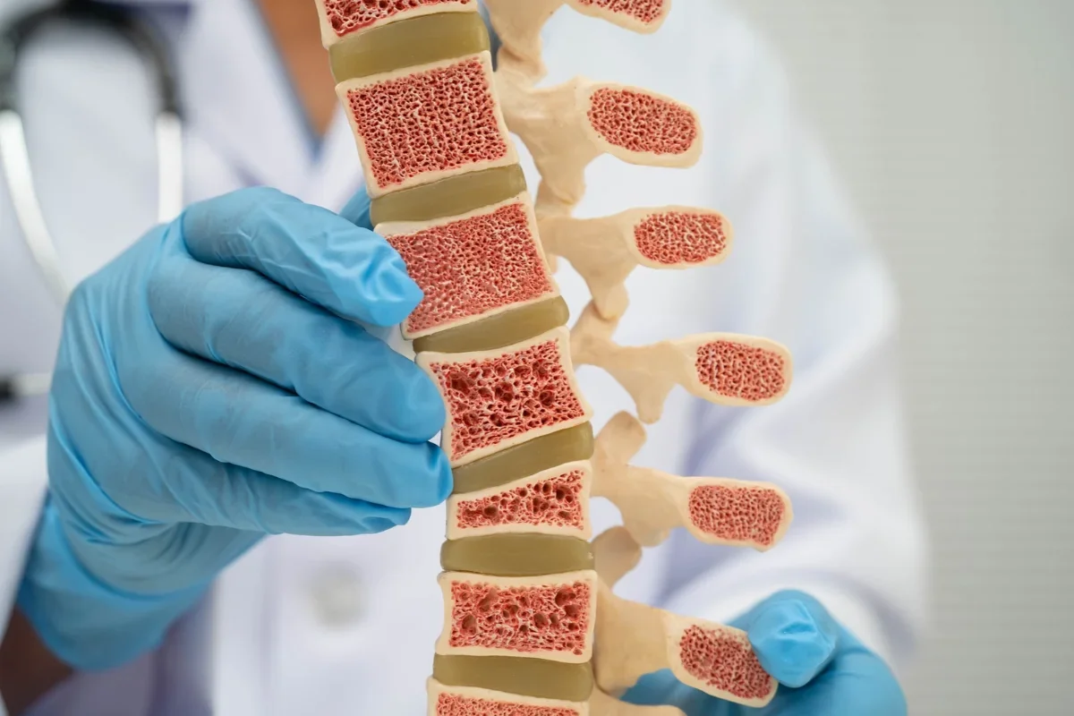 osteodensitometria REMS bilet de trimitere