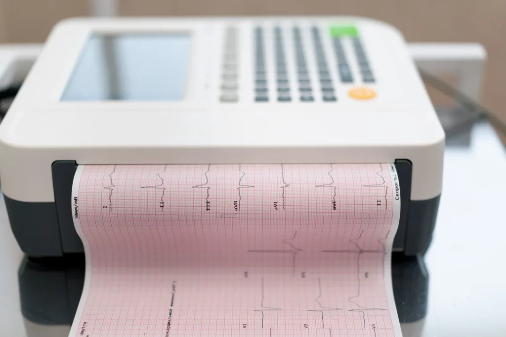 Holter EKG Timișoara